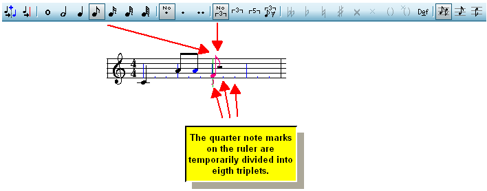 BeatRulerTemporaryTriplets